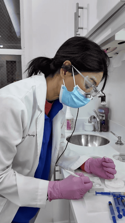 Benefits of minimal prep veneers